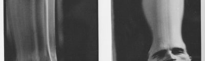 Man Ray, 'Distorsion'
